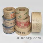 ӡ��ţƤ���z��